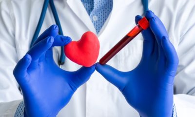 Laboratory medical diagnostics, tests for heart and cardiovascular-Myocardial Ischemia Industry | Myocardial Ischemia Industry: 2021 – 2027 | Featured
