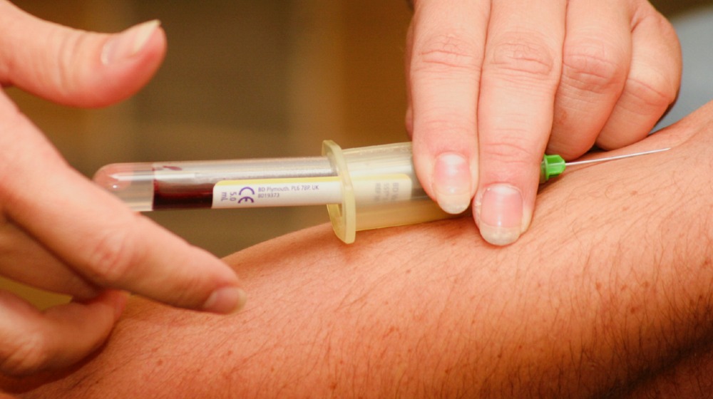 COVID-19 Treatment
